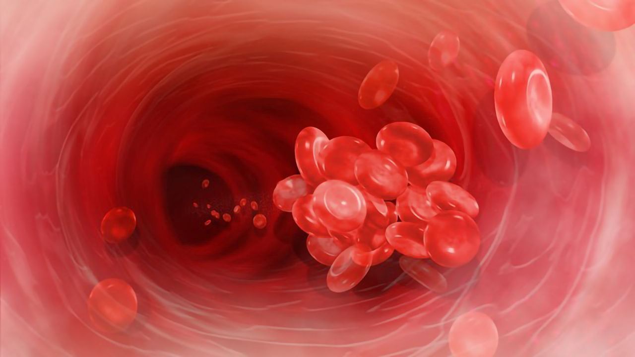 Rare Blood Clotting Disorder Risk Higher Following COVID-19 Than Post-Vaccination