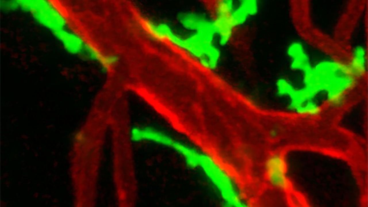 Vital Role Found for Macrophages in Healing