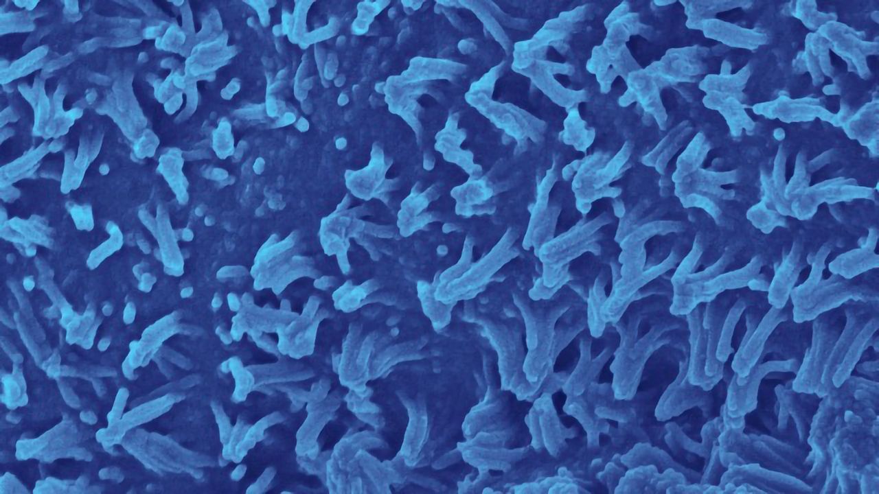 Advancing Research of Inflammatory Intestinal Diseases