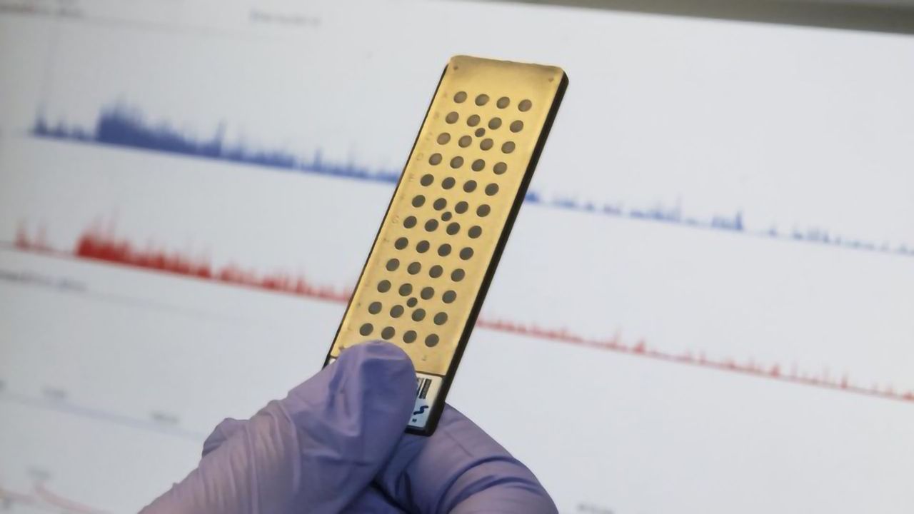 Innovative COVID-19 Test Pairs Mass Spectrometry With Machine Learning