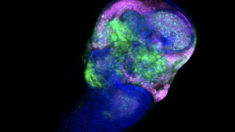 Dietary Amino Acid Defines the Fate of Cancer Cells