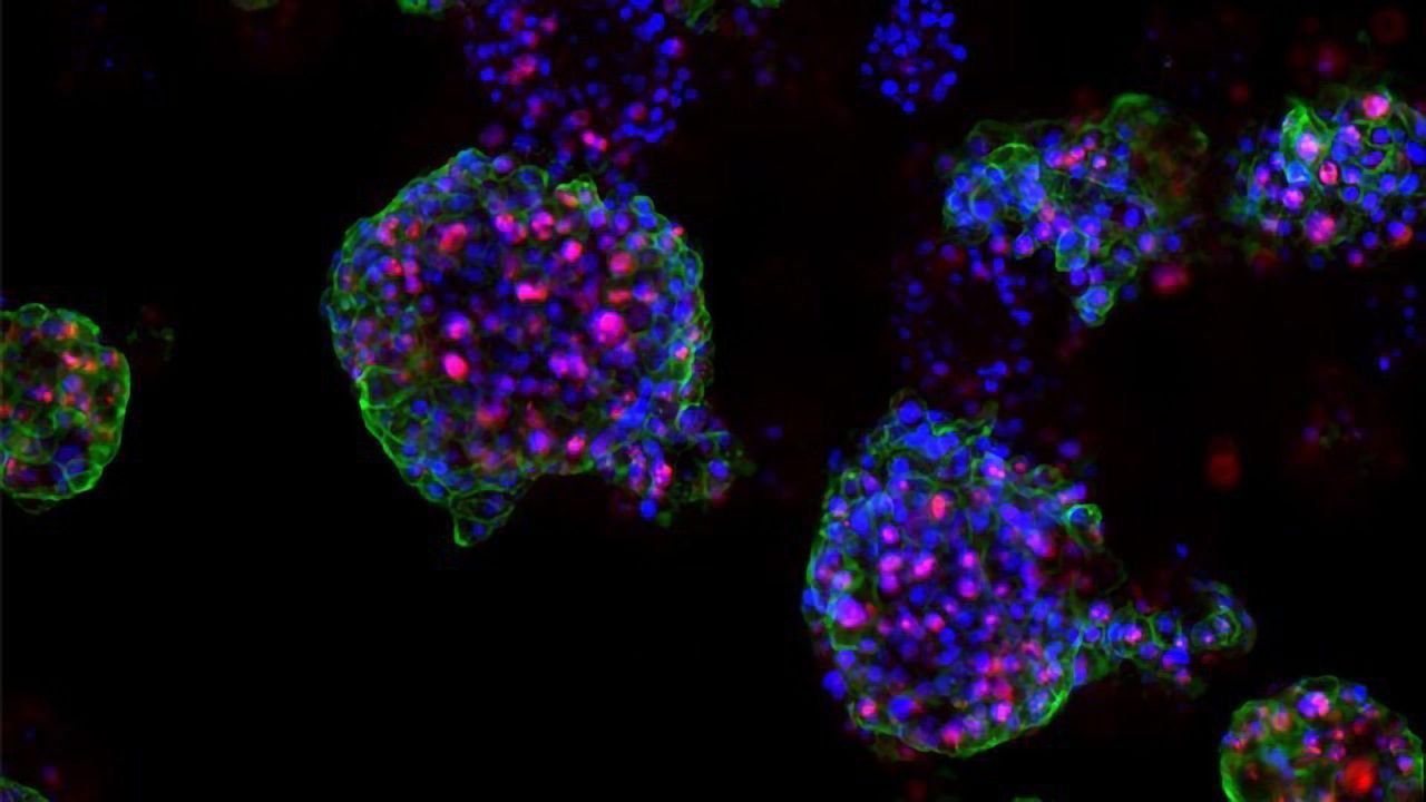 Proliferating Prostate Cancer Organoids