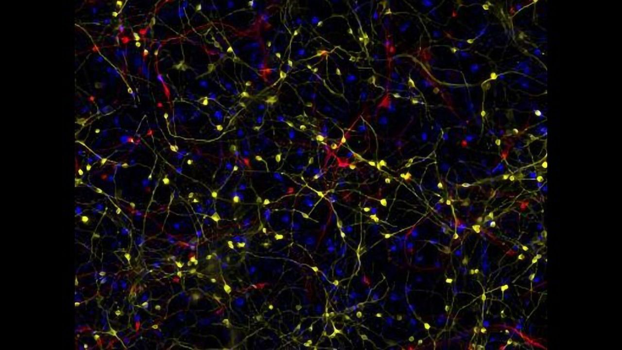 The Identity Crisis of Alzheimer's Brain Cells