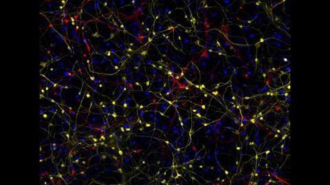 The Identity Crisis of Alzheimer's Brain Cells