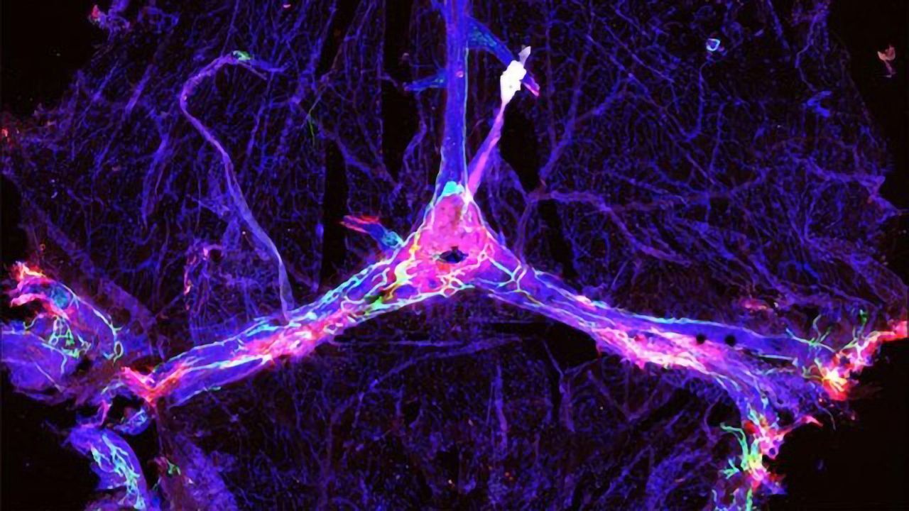 Boosting the Brain's Garbage Disposal Could Assist Alzheimer's Therapies