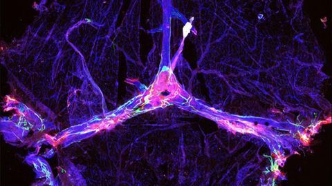 Boosting the Brain's Garbage Disposal Could Assist Alzheimer's Therapies
