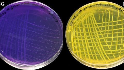Changes to Common Probiotic Could Help Infants With Gut Issues