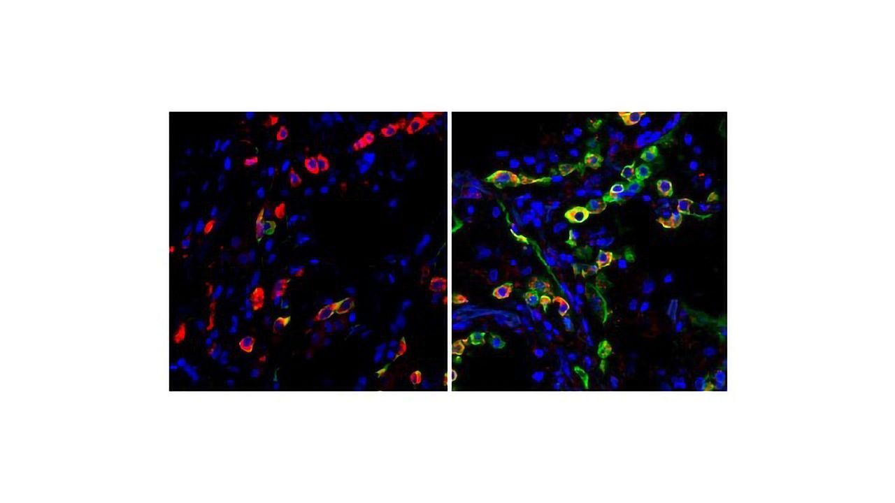 New COVID-19 Lung Cell Atlas Reveals Why SARS-CoV-2 Is Different