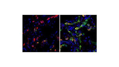 New COVID-19 Lung Cell Atlas Reveals Why SARS-CoV-2 Is Different
