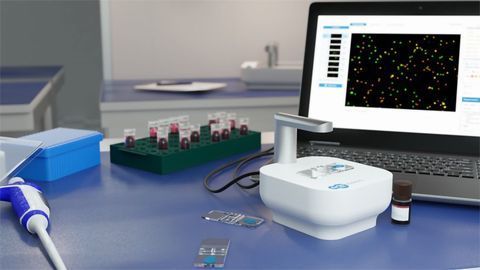 CytoSMART Redefines Automated Cell Counting With New Fluorescence Cell Counter
