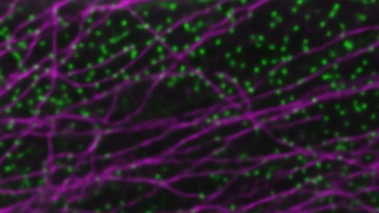 AI in Microscopy