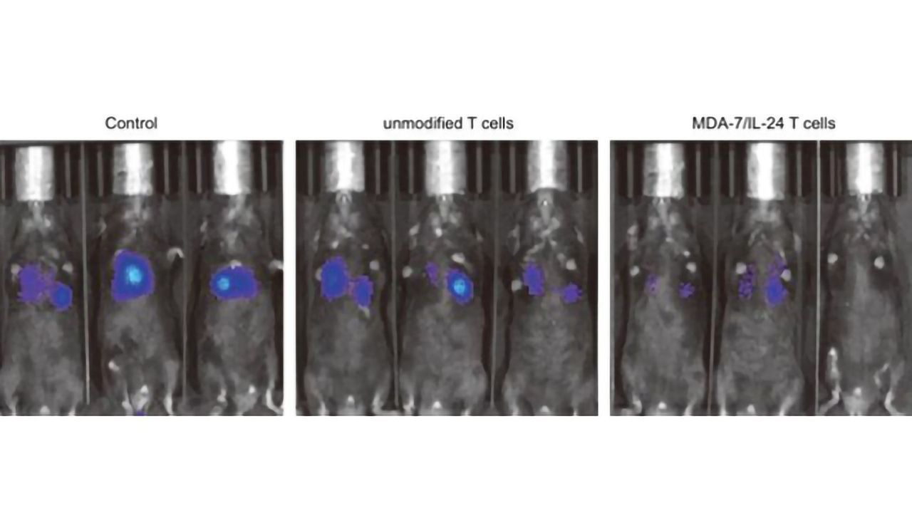T Cells Engineered To Attack a Variety of Cancers