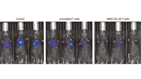 T Cells Engineered To Attack a Variety of Cancers