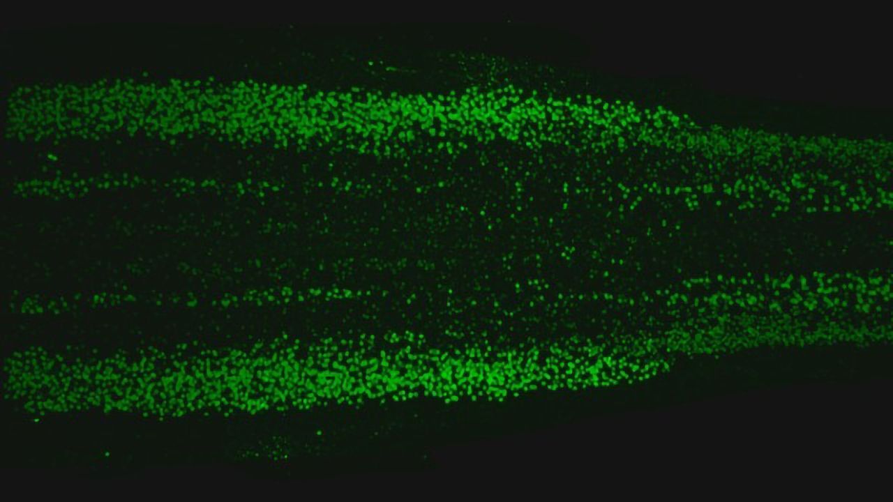 Genetic Sequencing Atlas Reveals Scale of Neuronal Diversity in the Spinal Cord