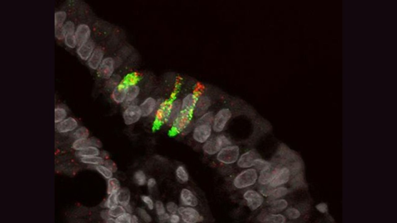 Rare Cell Type in the Small Intestine