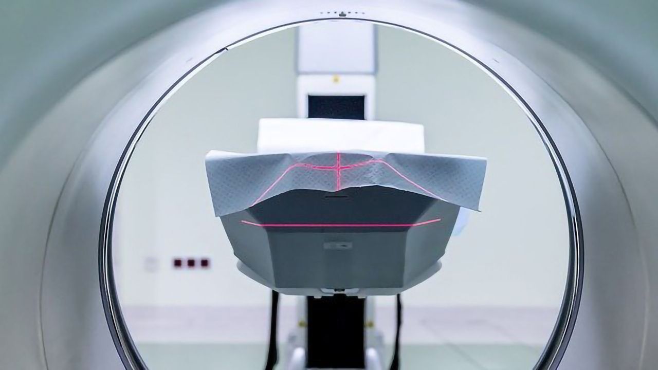 How Does Sensitivity Change the Brain?