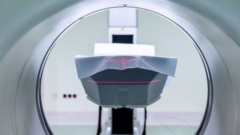 How Does Sensitivity Change the Brain?