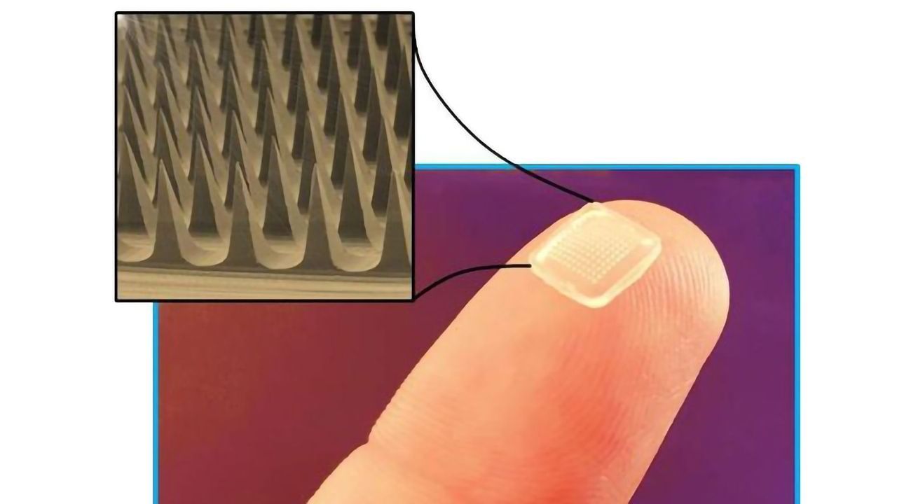 Microneedles for Painless Drug Delivery With Minimal Side Effects