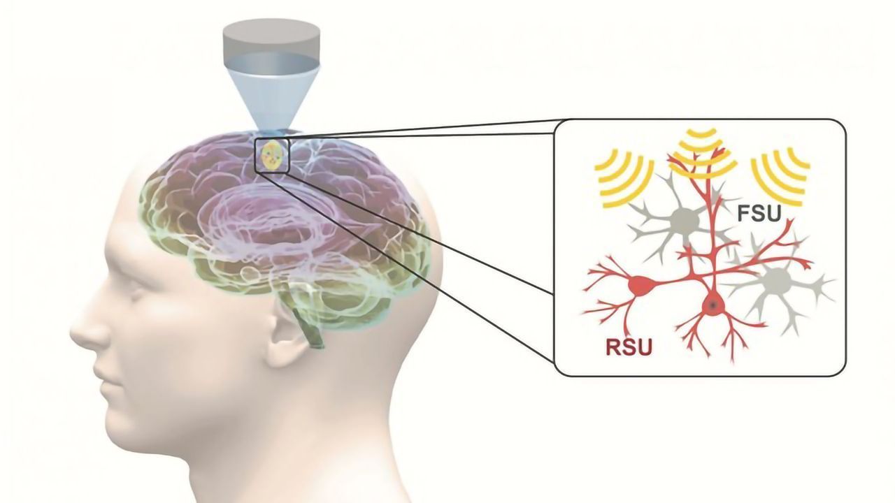 Forget Brain Surgery: Ultrasound Therapies Could Help Treat the Brain
