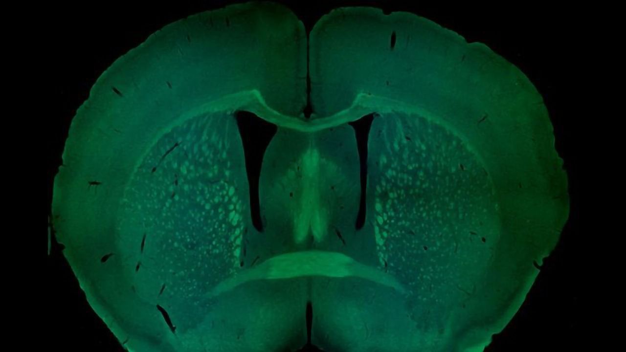 Sex-Specific Genetics of Autism Explored in Mice