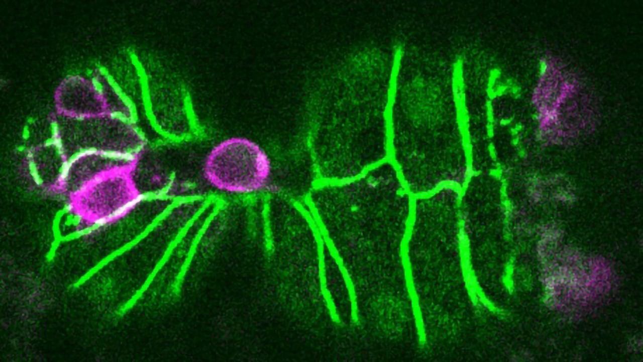 Cell Extrusion "Trigger" Could Protect Against Cancer