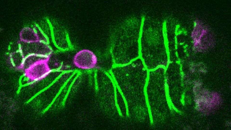Cell Extrusion "Trigger" Could Protect Against Cancer content piece image