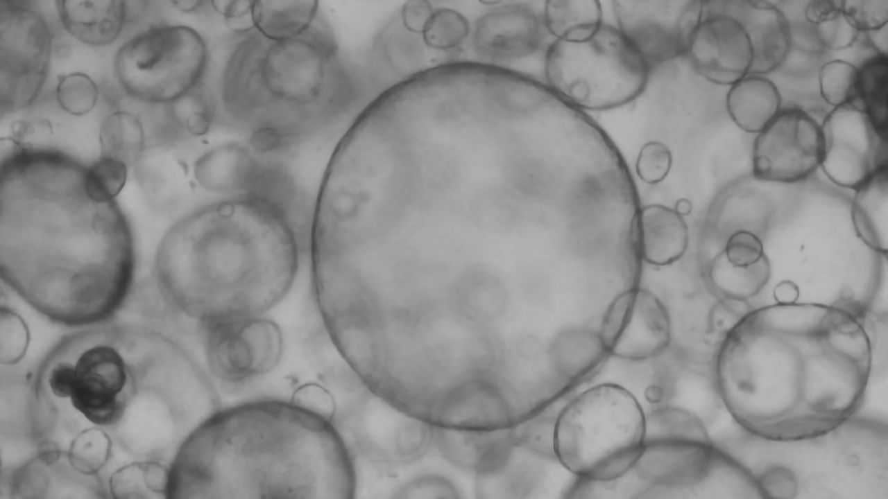 New Definition Aims To "Future-Proof" Organoids
