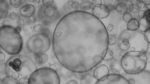 New Definition Aims To "Future-Proof" Organoids