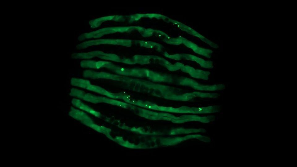 Worm Study Connects Specific Gut Bacteria to Neurodegenerative Proteins content piece image