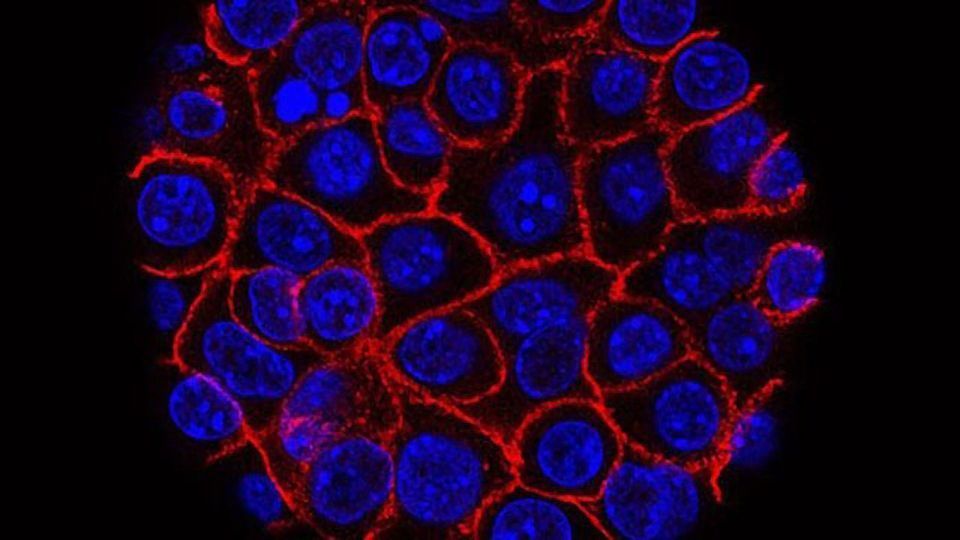Novel Vulnerabilities of Pancreatic Cancer Cells Revealed content piece image