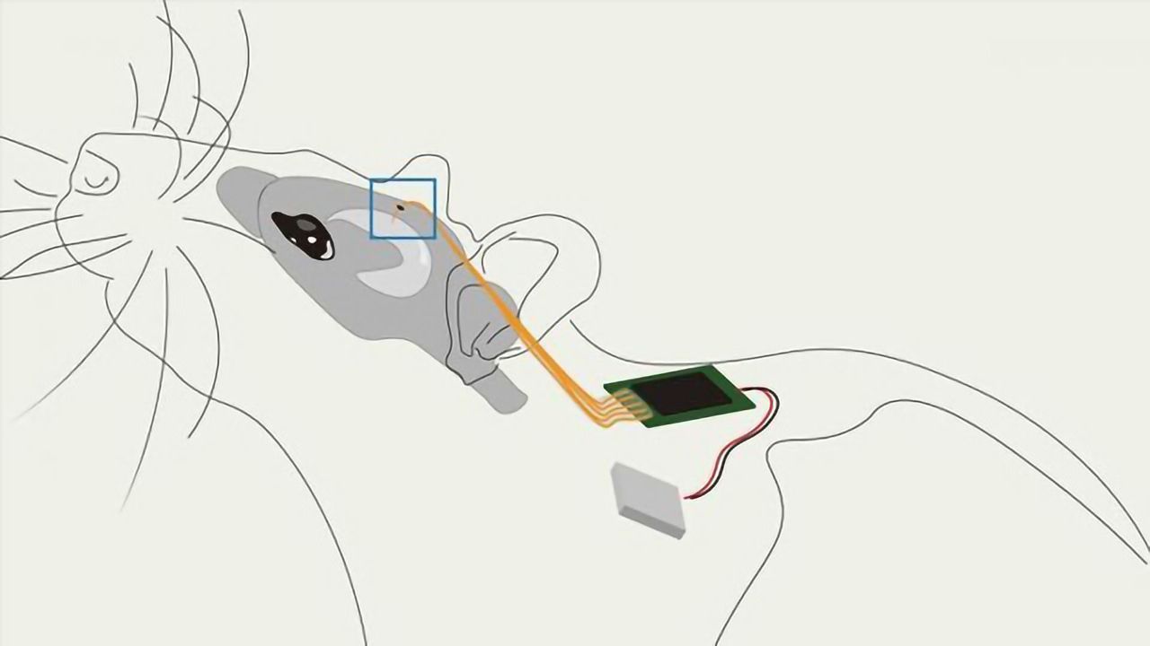 New Implant Is All-in-One System for Modifying Brain Circuits