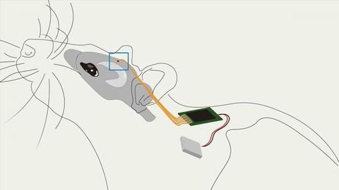 New Implant Is All-in-One System for Modifying Brain Circuits
