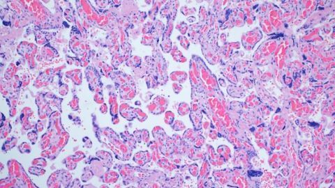 Study Finds COVID-19 Vaccines Do Not Damage the Placenta in Pregnancy