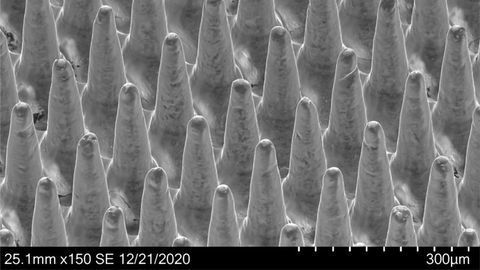 Skin-Patch Vaccine for Dengue Fever Successful in Preclinical Models