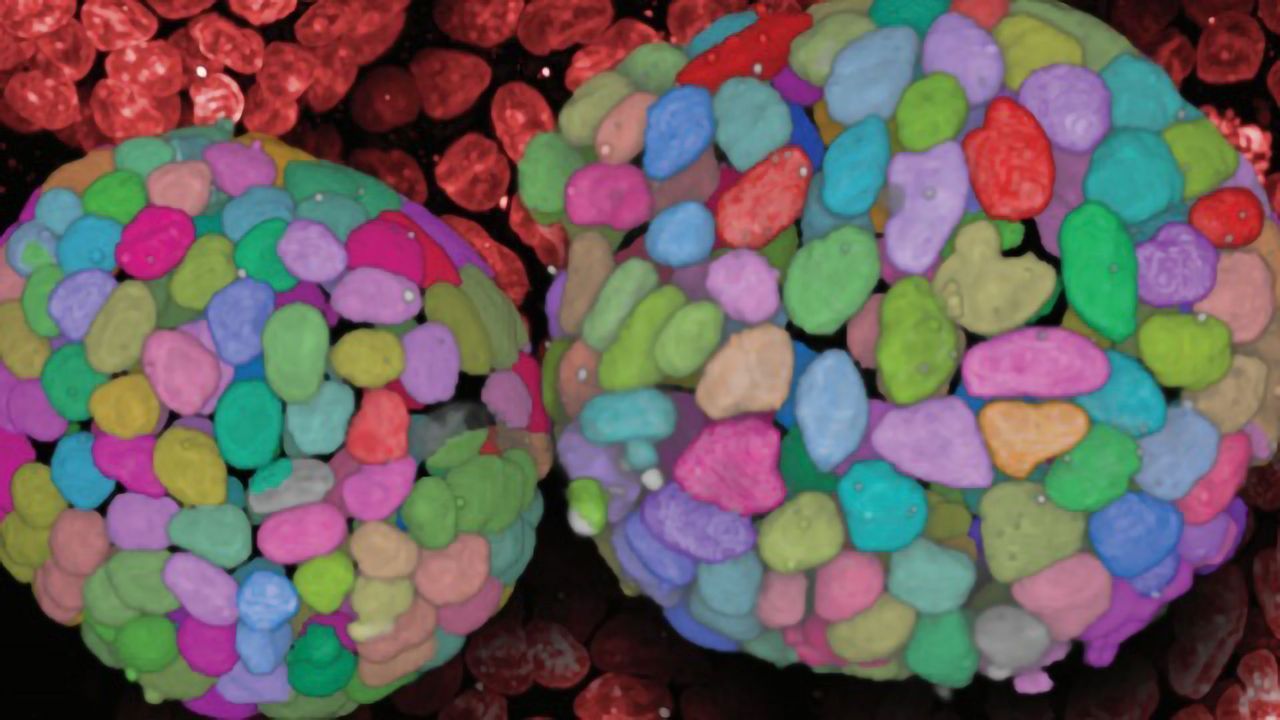 Five Top Tips for High-Content Screening in 3D