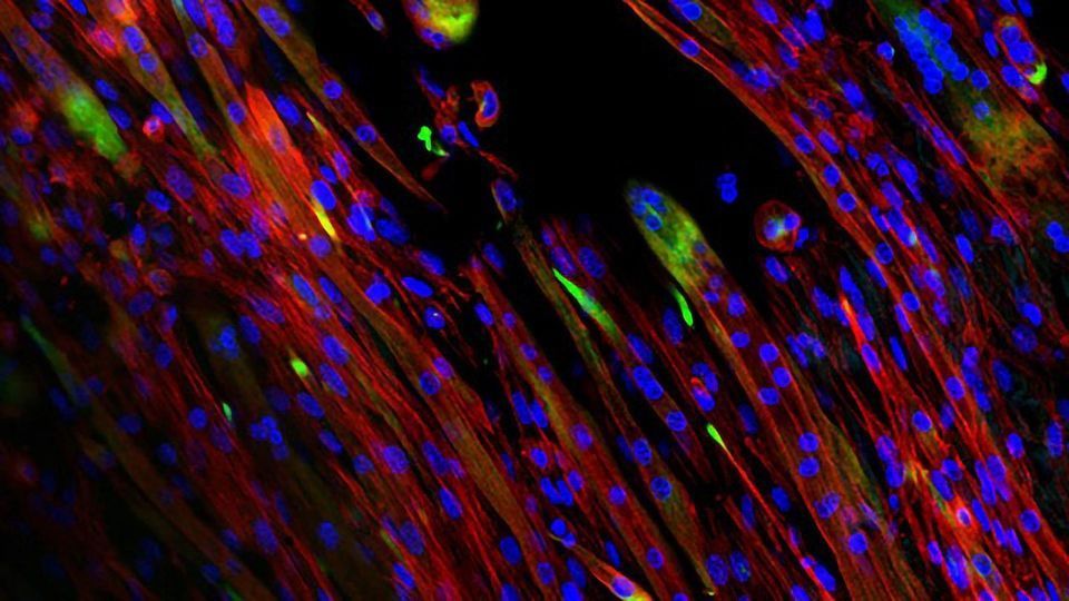 Bio-Inspired Scaffolds Help Promote Muscle Growth content piece image