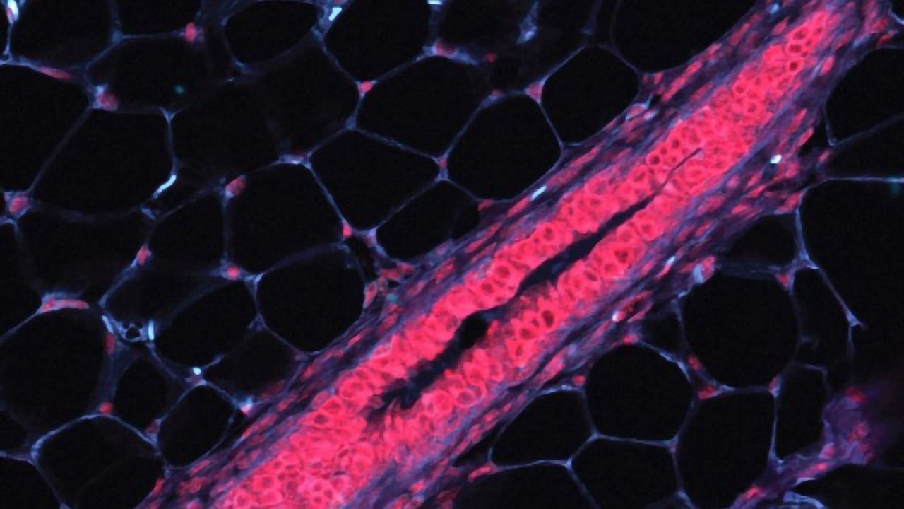 Cataloging Cells To Pinpoint Origins of Breast Cancer