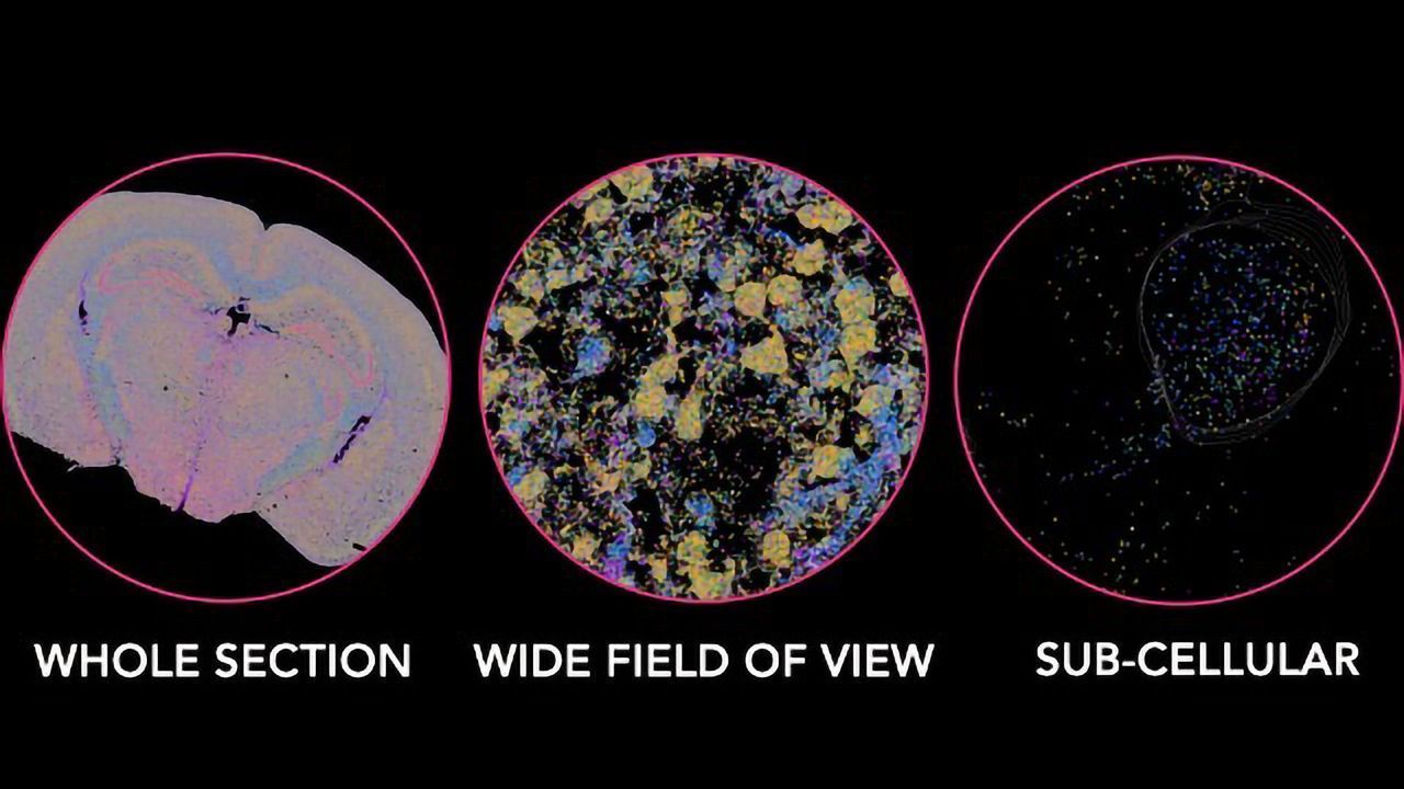 Trends, Applications and Advances in Spatial Transcriptomics