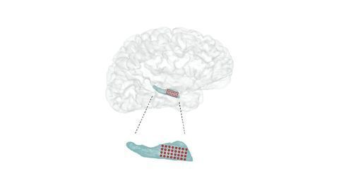 Epilepsy Researchers Observe New Complexity of Brain Waves in Memory Circuits