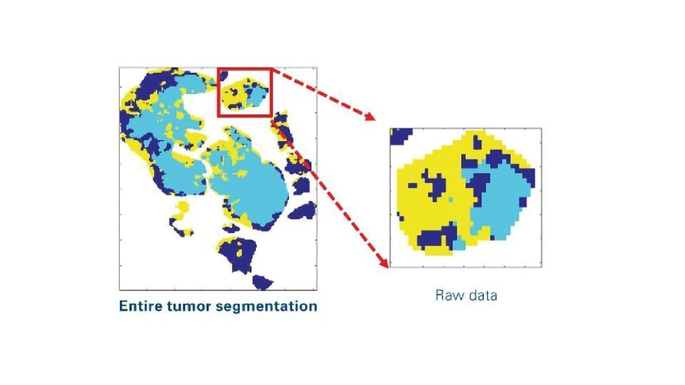 MALDI Imaging Empowers Omics in Spatial Context for Unprecedented Molecular Insight content piece image