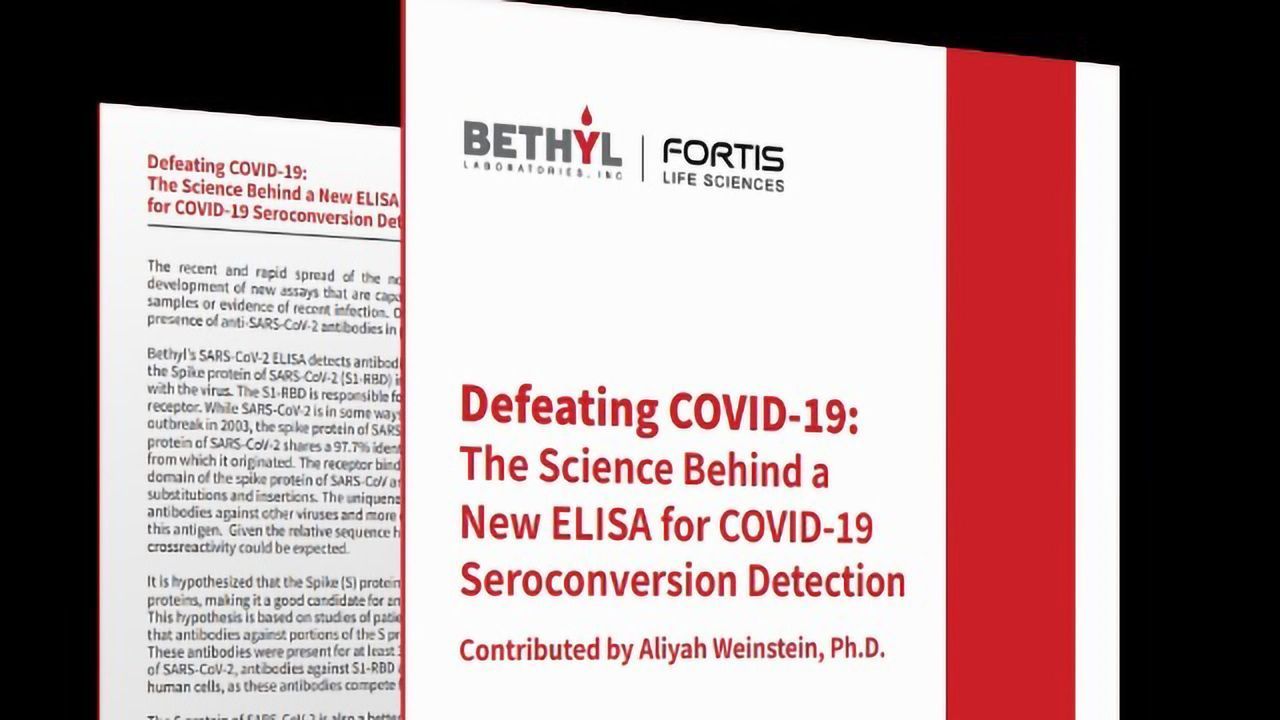Defeating COVID-19: Seroconversion Detection With ELISA