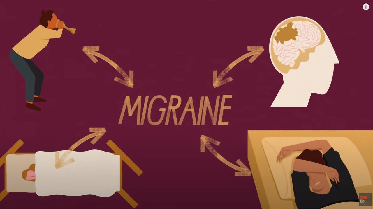 What Causes Migraines?