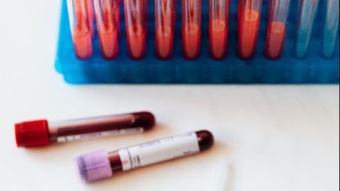 Blood-Based Biomarker Panel Can Distinguish Between Bacterial and Viral Infections