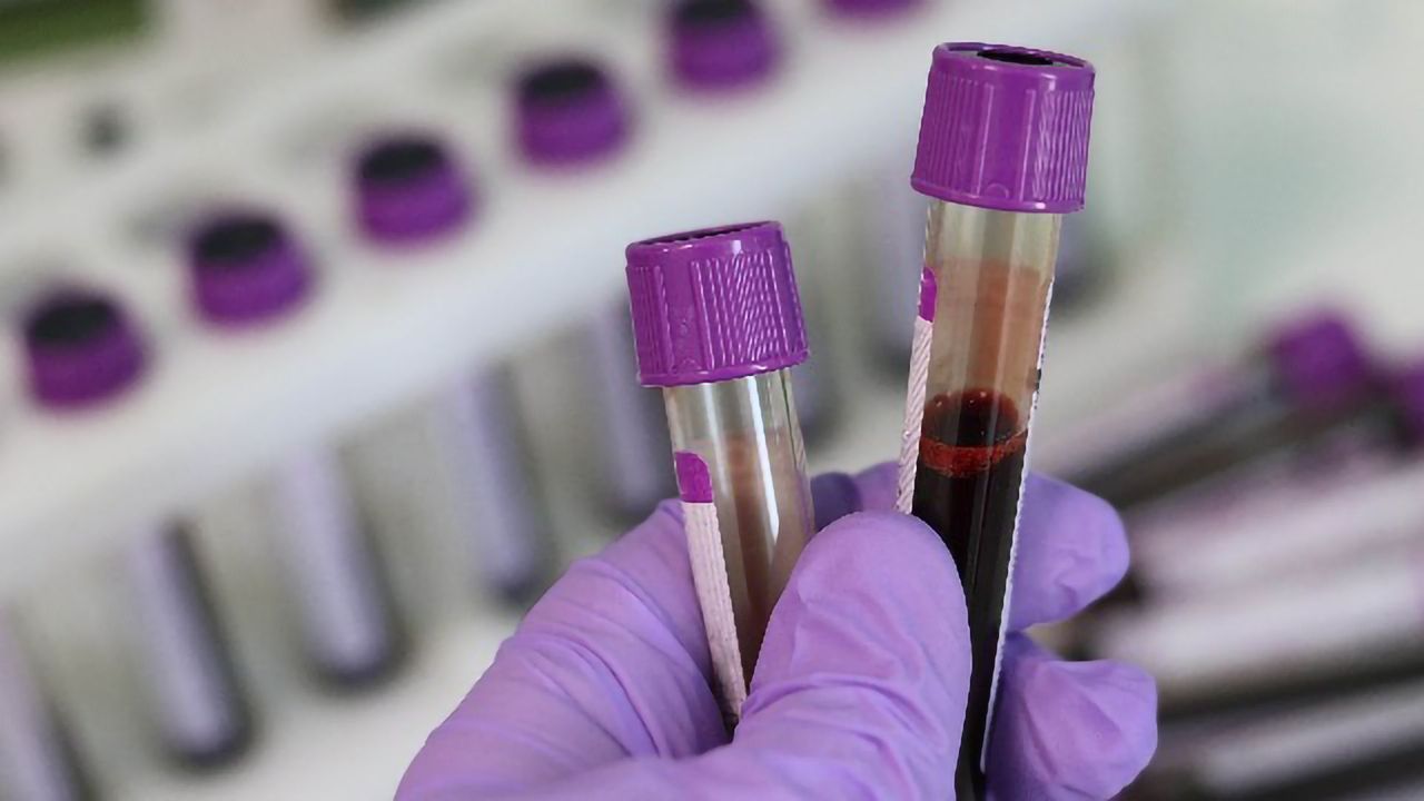 Nanoparticle-Based Sensors Enable Ultrasensitive Detection of Cancer Biomarkers