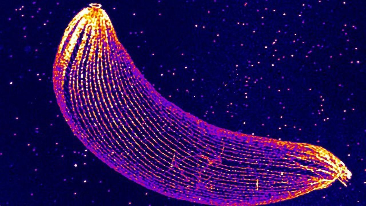 The Skeleton of the Malaria Parasite