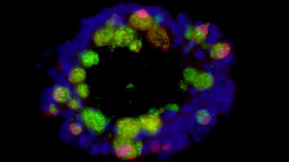 Western Diet Impairs the Gut's Immune System content piece image