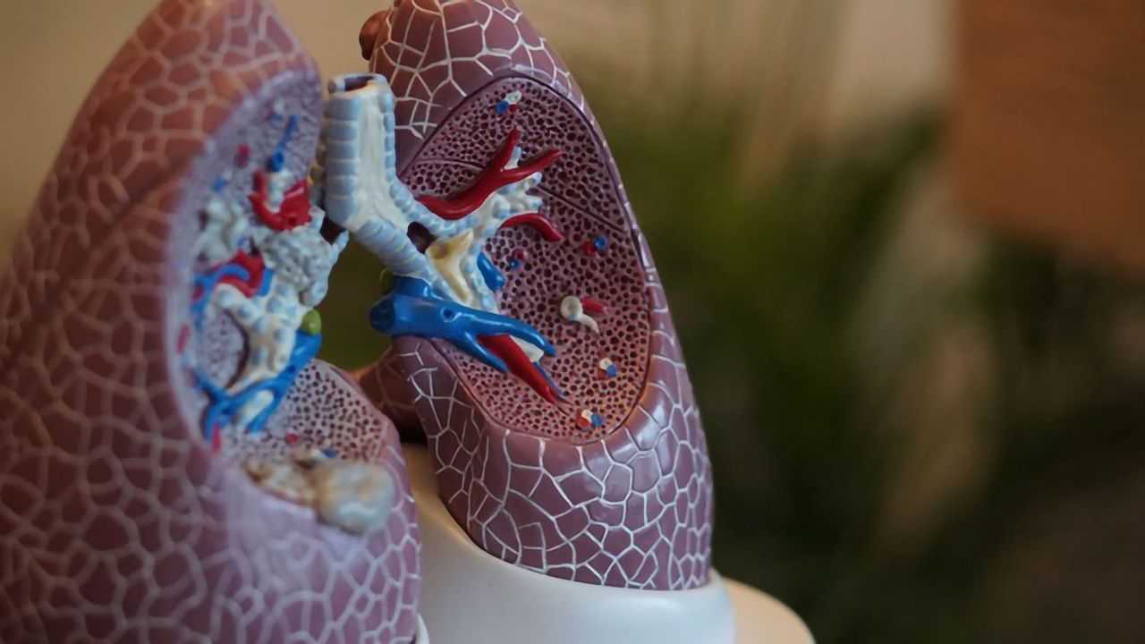 Triple-Drug Therapy Cuts Serious Asthma Flares