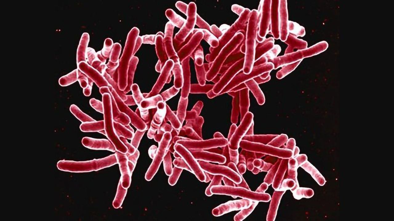 Shorter Multi-Drug Therapy for Tuberculosis Is As Effective As 6-Month Regimen