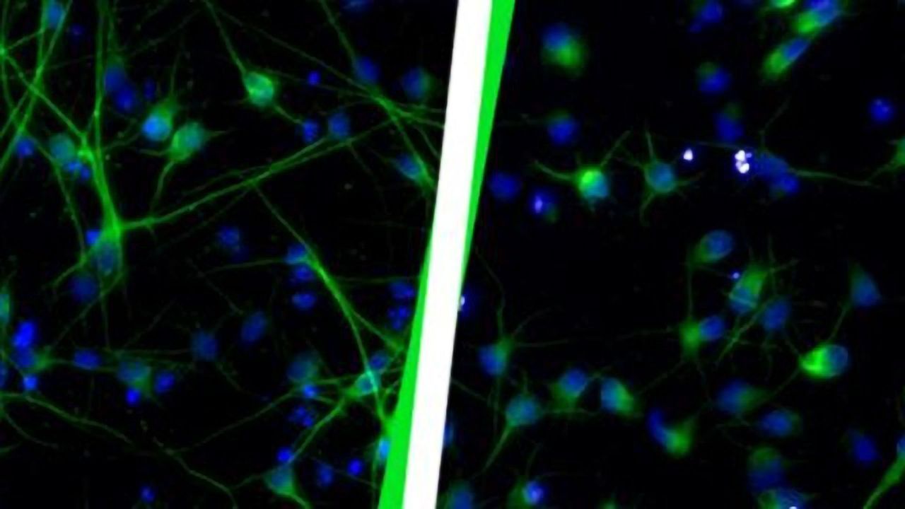 Brain Development Harmed by Viruses in Our Genome