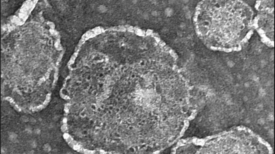 The Battle Between Pathogenic Shigella and Our Cells content piece image